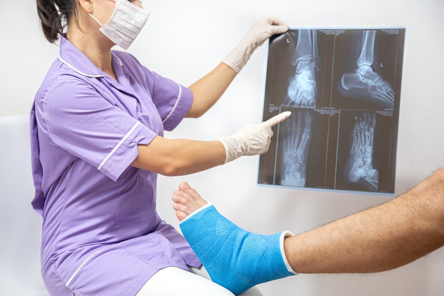 Joint Preservation Surgery consultation with a doctor examining a patient’s injured, casted foot while reviewing X-rays