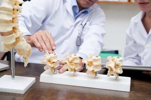 Doctors examining anatomical spine models while discussing spinal health and Osteoporosis