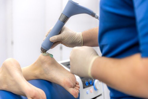 Ankle Arthroscopy treatment with a medical professional applying a therapeutic device to a patient's ankle